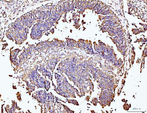 a02157 2 dusp6 primary antibodies ihc testing 4