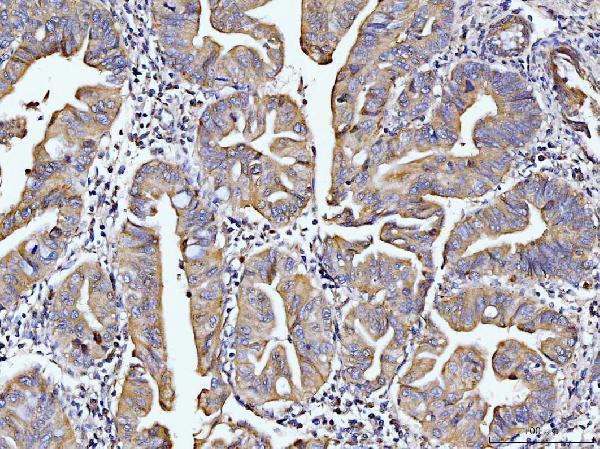 a02157 2 dusp6 primary antibodies ihc testing 5