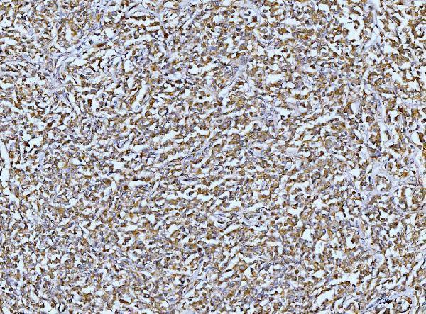 a02157 2 dusp6 primary antibodies ihc testing 6