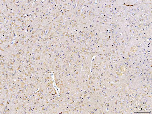 a02157 2 dusp6 primary antibodies ihc testing 7