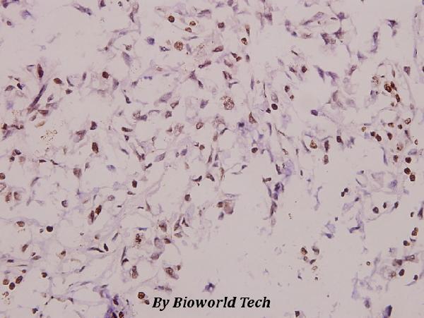 a02157 dusp6 primary antiboties ihc testing 2