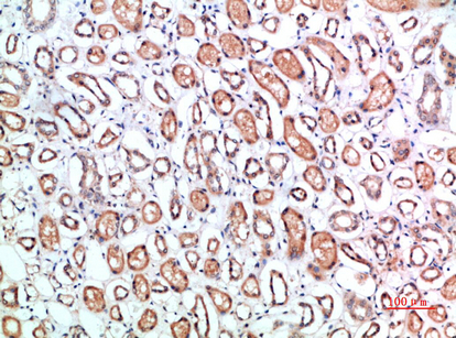 a02158 cd1b primary antibodies ihc testing 2
