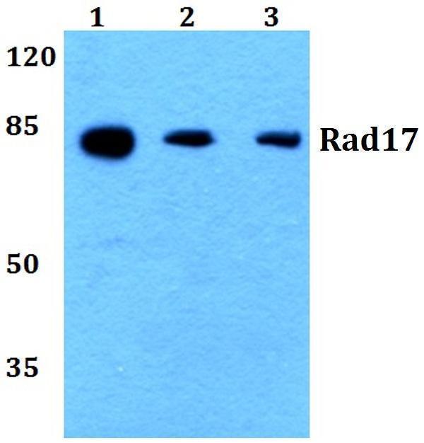 Western blot (WB) analysis of Rad17 (A639) pAb at 1:500 dilution
Lane1:SGC7901 whole cell lysate(20ug)
Lane2:HCT116 whole cell lysate(20ug)
Lane3:C6 whole cell lysate(40ug)
Lane4:CT26 whole cell lysate(40ug)
