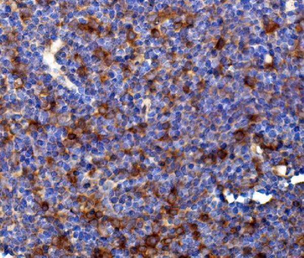  IHC analysis of Rad17 using anti-Rad17 antibody (A02159-2)