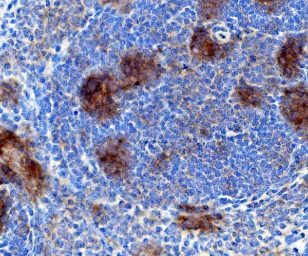  IHC analysis of Rad17 using anti-Rad17 antibody (A02159-2)