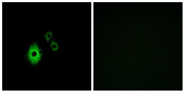 a02160 kcnj5 primary antibodies if testing 1