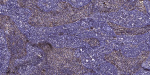 a02160 kcnj5 primary antibodies ihc testing 2