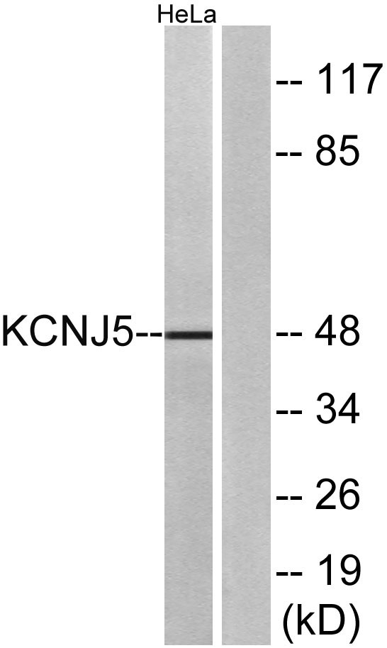 a02160 kcnj5 primary antibodies wb testing 3
