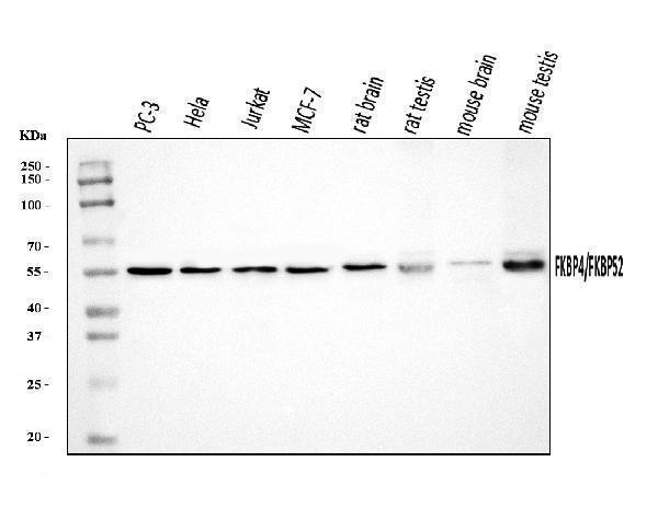  Western blot analysis of FKBP52/FKBP4 using anti-FKBP52/FKBP4 antibody (A02165-3)