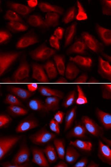 a02165 fkbp4 primary antiboties if testing 3