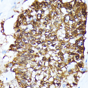 a02165 fkbp4 primary antiboties ihc testing 2