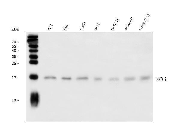  Western blot analysis of Acid phosphatase/ACP1 using anti-Acid phosphatase/ACP1 antibody (A02167-1)