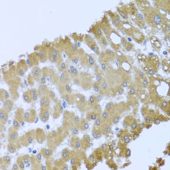Immunohistochemistry of paraffin-embedded mouse kidney using ACP1 antibody  at dilution of 1:100 