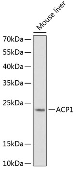 Western blot analysis of extracts of mouse liver, using ACP1 Antibody  at 1:1000 dilution