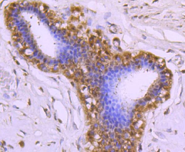 a02169 1 cdc37 primary antiboties ihc testing 2