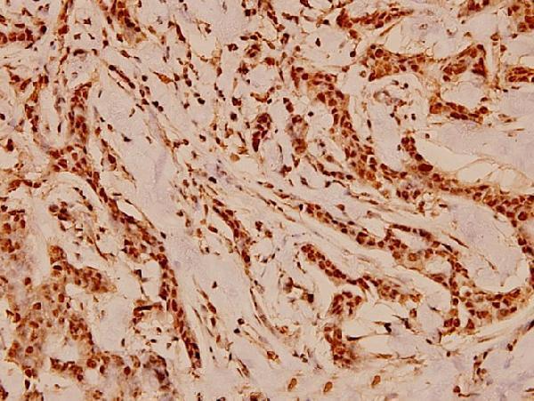 a02169 cdc37 primary antiboties ihc testing 2