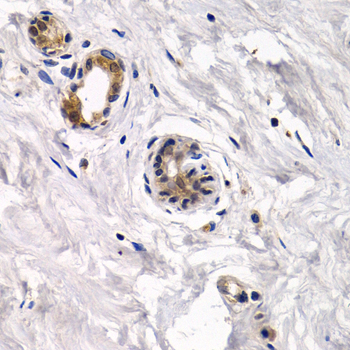 Immunofluorescence analysis of L929 cells using CAPN3 Rabbit pAb  at dilution of 1:100 
