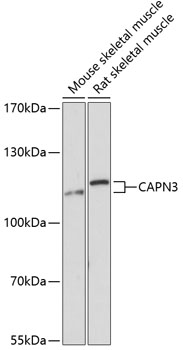 Western blot analysis of extracts of various cell lines, using CAPN3 Antibody  at 1:3000 dilution