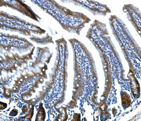  IHC analysis of Btc using anti-Btc antibody (A02171-4)