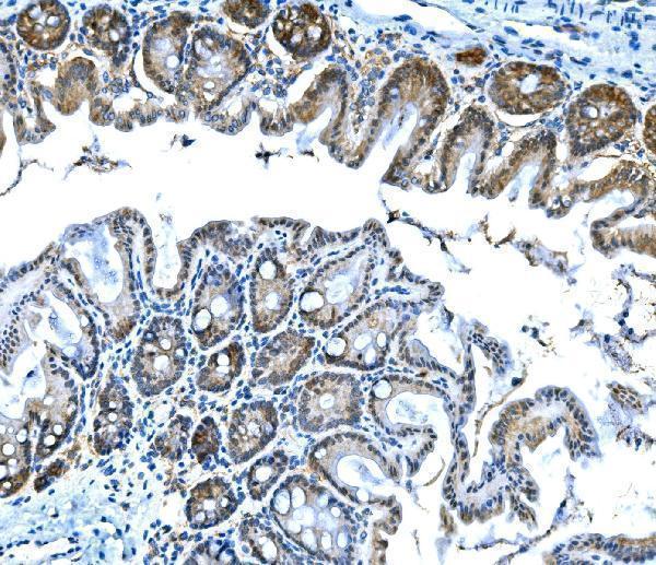  IHC analysis of Btc using anti-Btc antibody (A02171-4)