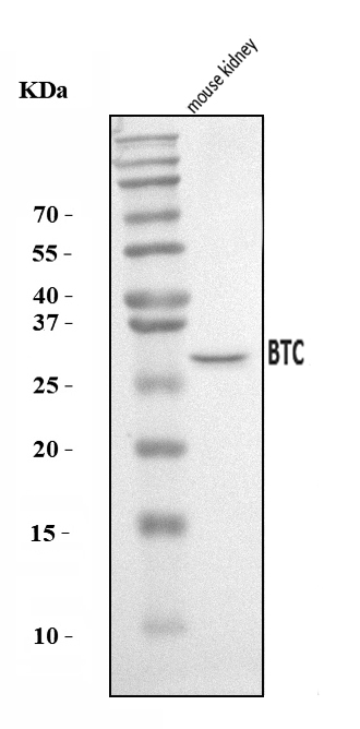  Western blot analysis of Btc using anti-Btc antibody (A02171-4)