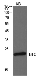 Western Blot analysis of KB cells using Probetacellulin Polyclonal Antibody