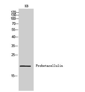 Western Blot analysis of KB cells using Probetacellulin Polyclonal Antibody