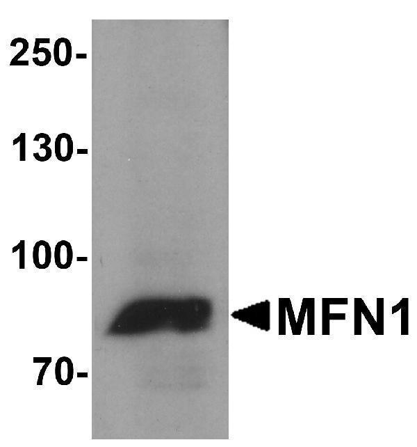 Western blot analysis of MFN1 in A431 cell lysate with MFN1 antibody at 1 μg/ml
