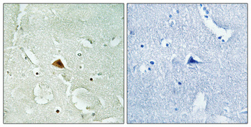 a02174 2 rad23b primary antibodies ihc testing 1