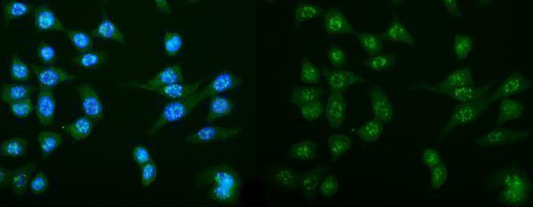 a02175 2 dctn1 primary antibodies if testing 8