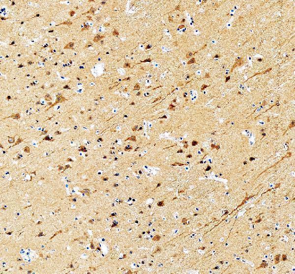 a02175 2 dctn1 primary antibodies ihc testing 1