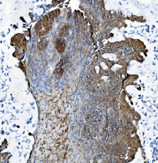 a02175 2 dctn1 primary antibodies ihc testing 2
