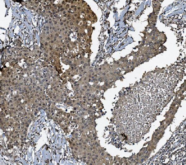 a02175 2 dctn1 primary antibodies ihc testing 4