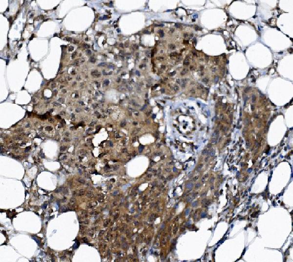 a02175 2 dctn1 primary antibodies ihc testing 5