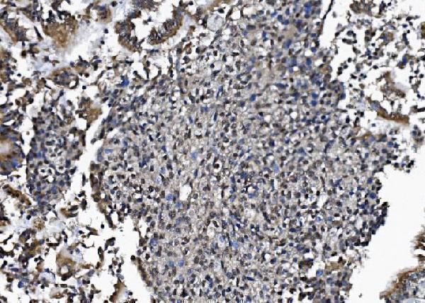 a02175 2 dctn1 primary antibodies ihc testing 6