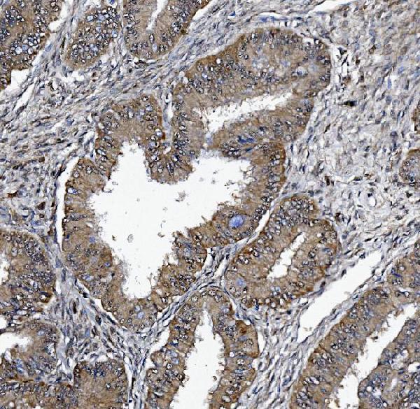a02175 2 dctn1 primary antibodies ihc testing 7