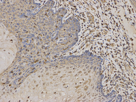 Immunoprecipitation analysis of 200ug extracts of MCF-7 cells, using 3 ug DCTN1 antibody 