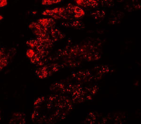 a02176 golga5 primary antibodies if testing 3