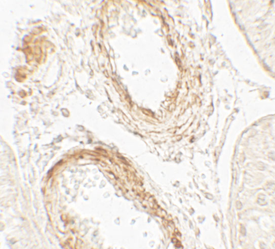 a02176 golga5 primary antibodies ihc testing 2