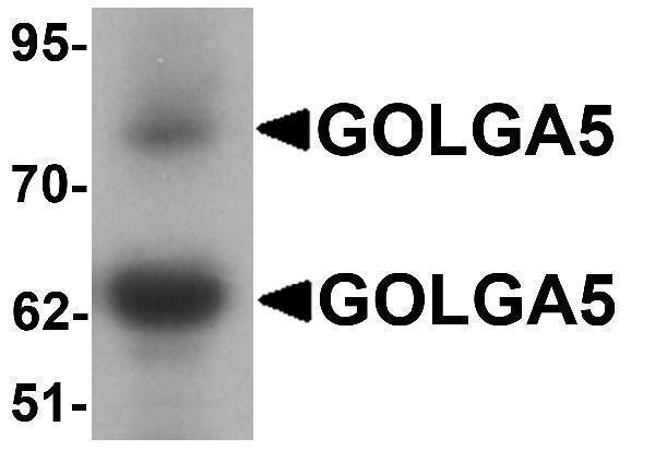 a02176 golga5 primary antibodies wb testing 1