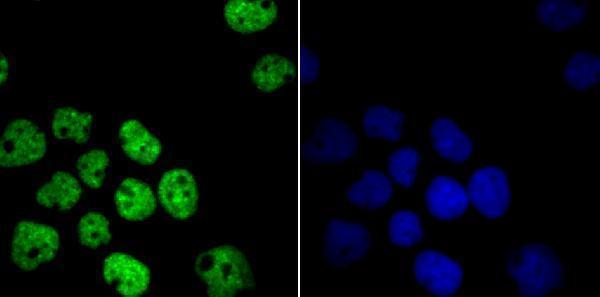 ICC staining HDAC9 in A431 cells (green)
