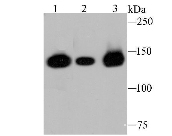 Western blot analysis of HDAC9 on different lysates using anti-HDAC9 antibody at 1/1,000 dilution