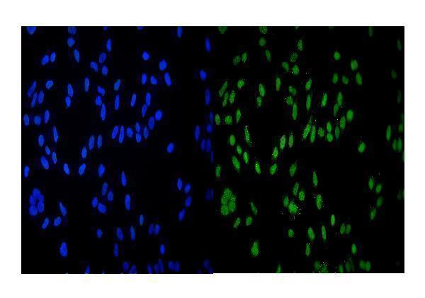  IF analysis of HDAC9 using anti-HDAC9 antibody (A02177-4)