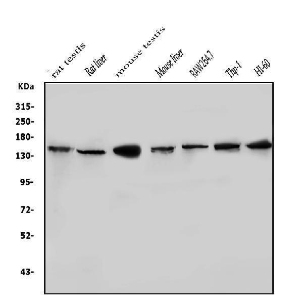  Western blot analysis of HDAC9 using anti-HDAC9 antibody (A02177-4)