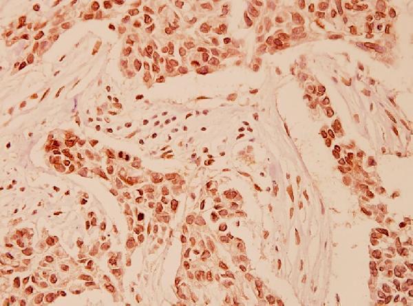 a02177 hdac9 primary antiboties ihc testing 2