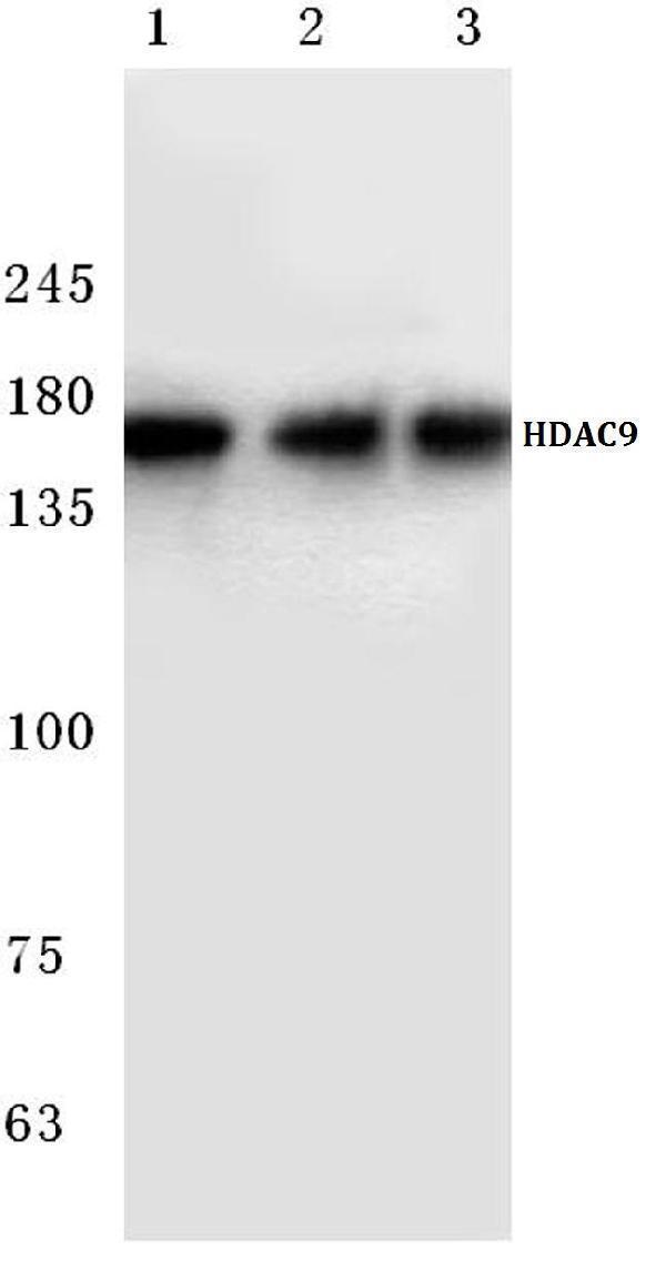 a02177 hdac9 primary antiboties wb testing 1