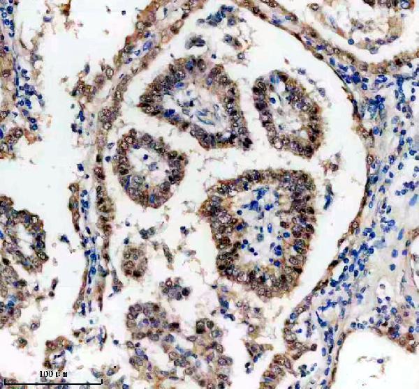 IHC analysis of EGLN3 using anti-EGLN3 antibody (A02182-2)