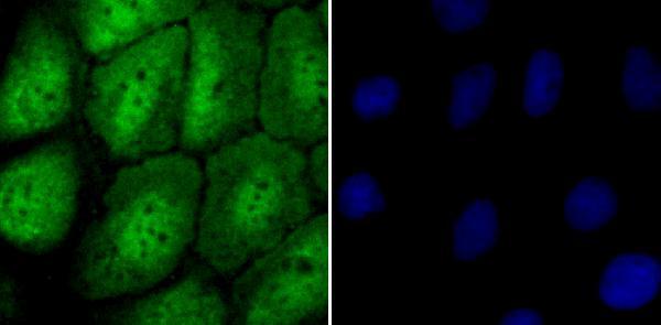 ICC staining NUP153 in A431 cells (green)