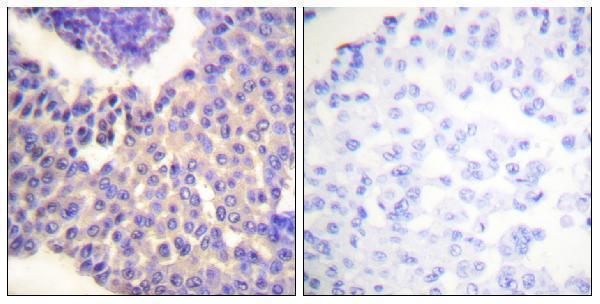 a02185s412 arrb1 primary antibodies ihc testing 1