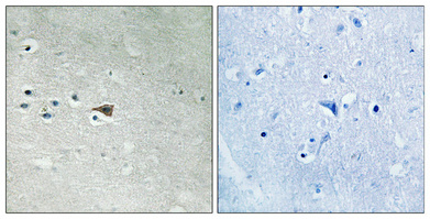a02185s412 arrb1 primary antibodies ihc testing 3